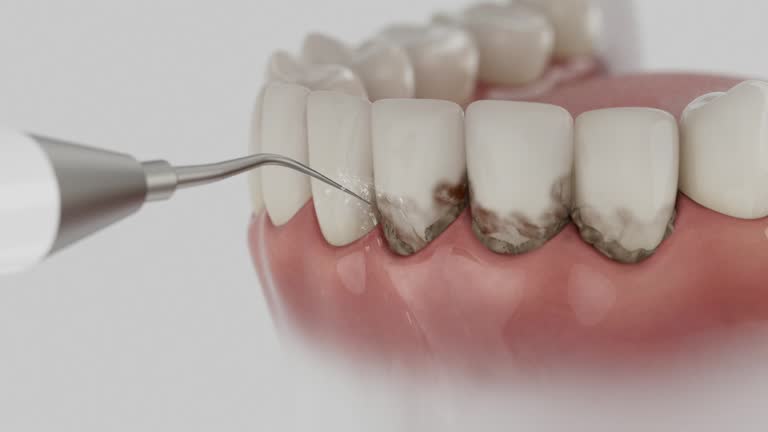 Reliable Dental contractor in Belvedere, CA by Dentist Open Now
